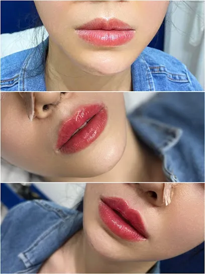 D’oro Beauty - Tiêm Filler Botox uy tín tại Đà Nẵng