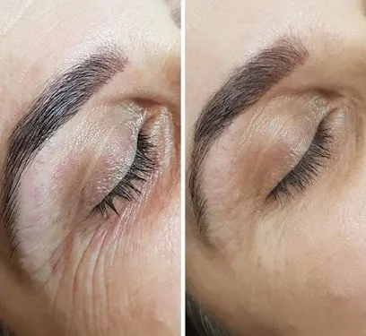 KT Korea Beauty-Best Facial-Acne/Darkspots/SkinTag/Hifu/Microneedling Treatment-Skin Care Clinic-Filler Botox Meso-Laser Hair