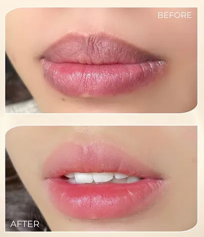 Lamer Premium Spa (Botox Filler. Skin Treatment. Beauty Clinic)