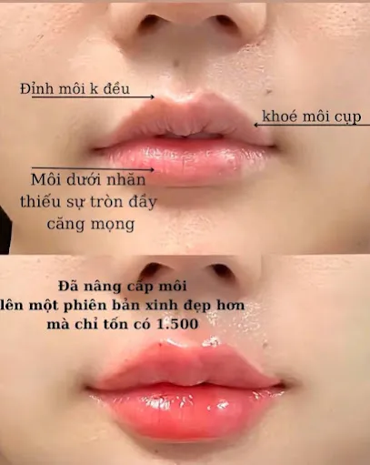 Ny Beauty - Filler Botox - Phun Xăm Thẩm Mỹ